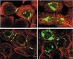 Localisation studies of transfected wildtype (WT) and skin disease associated mutant R42P Connexin 31 in keratinocytes. 