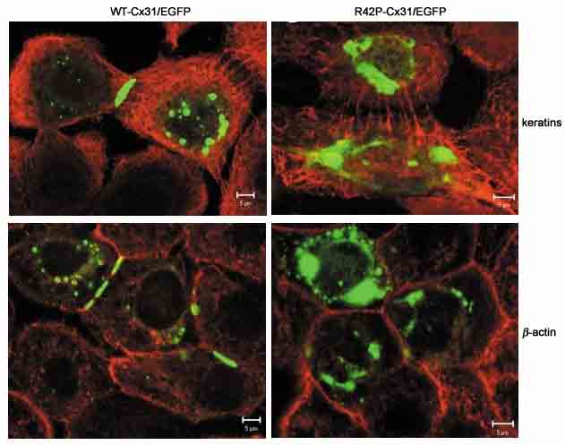 Localisation studies of transfected wildtype (WT) and skin disease associated mutant R42P Connexin 31 in keratinocytes. 