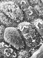 Scanning electron microscopy of epithelial surface. The surface of the epithelium is coated with small projections (microvilli), which together with mucus limit the proximity of bacteria.