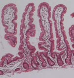 Cross section of the small intestine examined by light microscopy. The small intestine is composed of finger-like villi. It is lined with epithelial cells,which absorb food, and provide a barrier to the outside world.