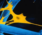 Human fibroblasts cultured on a hyaluronic acid tissue engineered scaffold