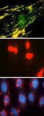 Immunofluorescence microscopy of the interaction of a cysteine protease of the oral bacterium, Porphyromonas gingivalis, with human fibroblasts showing binding to fibronectin (top panel) and with epithelial cells showing nuclear localisation (middle and bottom panel).
