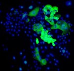 A colony of human oral mucosal cells growing in tissue culture and stained for keratin 19, a putative stem cell marker