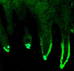 A section of human oral mucosa stained to show the distribution of keratin 19. a marker of stem cell zones and Merkel cells.