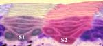 A section of mouse skin treated to show its columnar units of structure with the position of the related stem cells indicated as S1 and S2