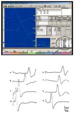 Sensory function tests